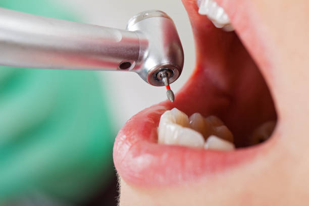 Best Weekend Emergency Dentist in Turpin Hills, OH